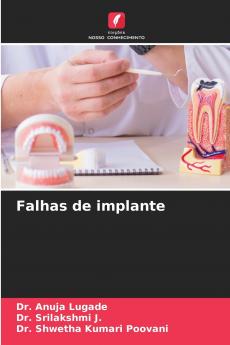 Falhas de implante