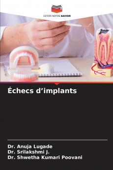 Échecs d'implants