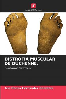 DISTROFIA MUSCULAR DE DUCHENNE