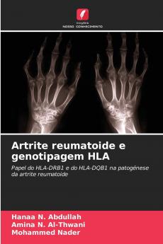 Artrite reumatoide e genotipagem HLA