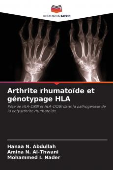 Arthrite rhumatoïde et génotypage HLA