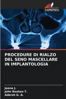 PROCEDURE DI RIALZO DEL SENO MASCELLARE IN IMPLANTOLOGIA