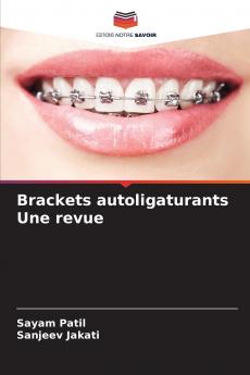 Brackets autoligaturants Une revue