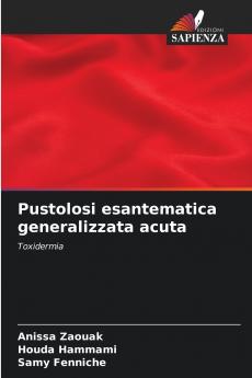 Pustolosi esantematica generalizzata acuta