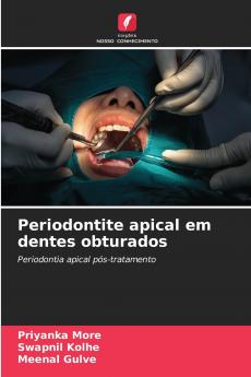 Periodontite apical em dentes obturados