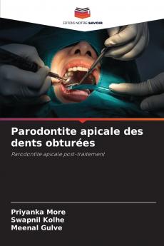 Parodontite apicale des dents obturées