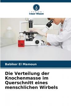 Die Verteilung der Knochenmasse im Querschnitt eines menschlichen Wirbels