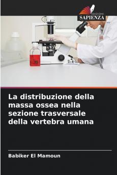 La distribuzione della massa ossea nella sezione trasversale della vertebra umana