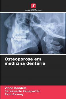 Osteoporose em medicina dentária