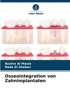 Osseointegration von Zahnimplantaten