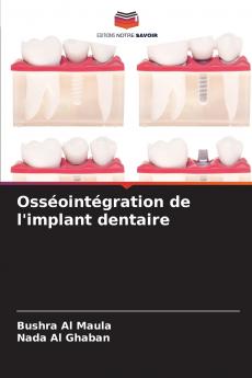 Osséointégration de l'implant dentaire