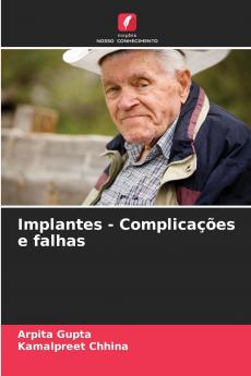 Implantes - Complicações e falhas