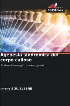 Agenesia sindromica del corpo calloso