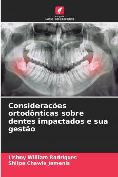Considerações ortodônticas sobre dentes impactados e sua gestão