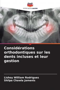 Considérations orthodontiques sur les dents incluses et leur gestion