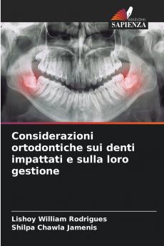 Considerazioni ortodontiche sui denti impattati e sulla loro gestione