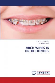 ARCH WIRES IN ORTHODONTICS