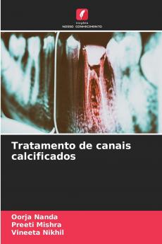 Tratamento de canais calcificados