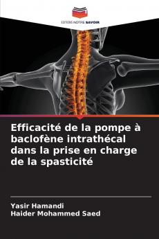 Efficacité de la pompe à baclofène intrathécal dans la prise en charge de la spasticité