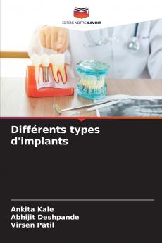Différents types d'implants