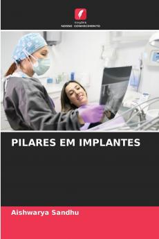 PILARES EM IMPLANTES