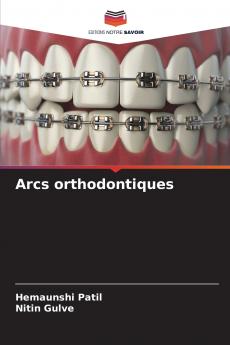 Arcs orthodontiques