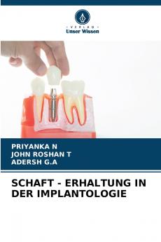 SCHAFT - ERHALTUNG IN DER IMPLANTOLOGIE