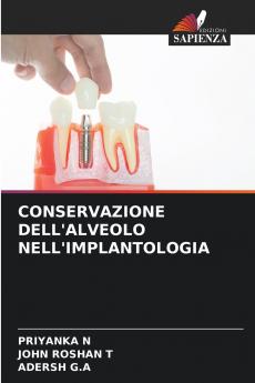 CONSERVAZIONE DELL'ALVEOLO NELL'IMPLANTOLOGIA