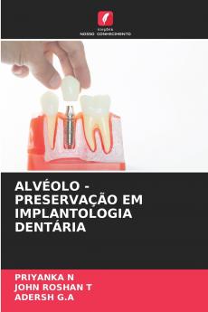 ALVÉOLO - PRESERVAÇÃO EM IMPLANTOLOGIA DENTÁRIA