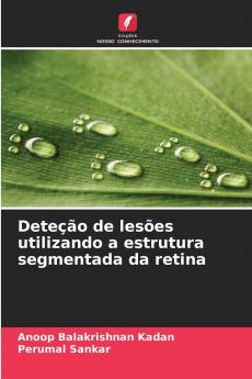 Deteção de lesões utilizando a estrutura segmentada da retina
