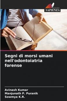 Segni di morsi umani nell'odontoiatria forense