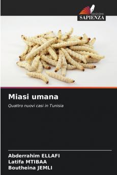 Miasi umana