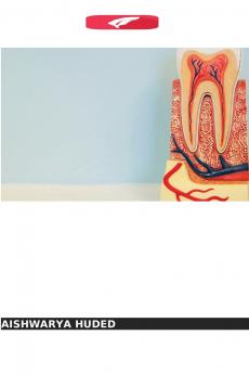 SELANTES DE CANAIS RADICULARES