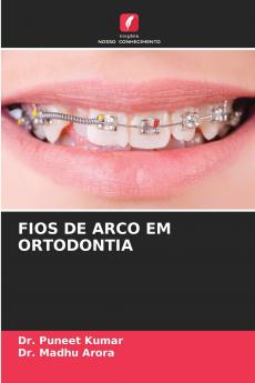 FIOS DE ARCO EM ORTODONTIA