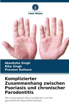 Komplizierter Zusammenhang zwischen Psoriasis und chronischer Parodontitis