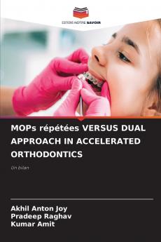 MOPs répétées VERSUS DUAL APPROACH IN ACCELERATED ORTHODONTICS