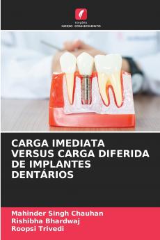 CARGA IMEDIATA VERSUS CARGA DIFERIDA DE IMPLANTES DENTÁRIOS