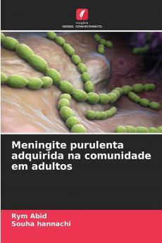 Meningite purulenta adquirida na comunidade em adultos
