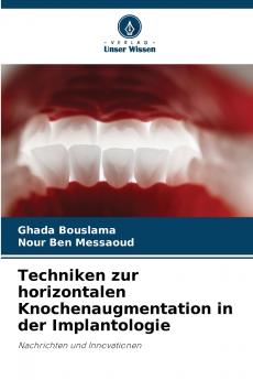 Techniken zur horizontalen Knochenaugmentation in der Implantologie