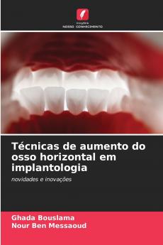 Técnicas de aumento do osso horizontal em implantologia
