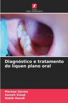 Diagnóstico e tratamento do líquen plano oral