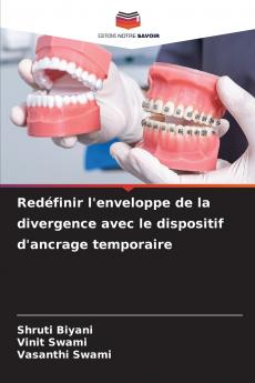 Redéfinir l'enveloppe de la divergence avec le dispositif d'ancrage temporaire