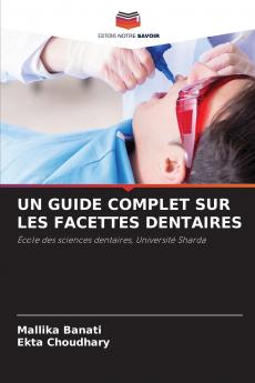 UN GUIDE COMPLET SUR LES FACETTES DENTAIRES