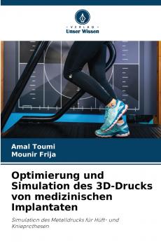 Optimierung und Simulation des 3D-Drucks von medizinischen Implantaten