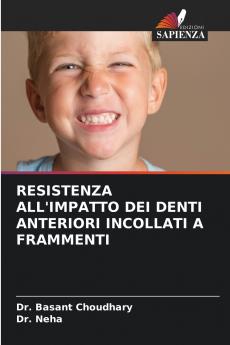 RESISTENZA ALL'IMPATTO DEI DENTI ANTERIORI INCOLLATI A FRAMMENTI
