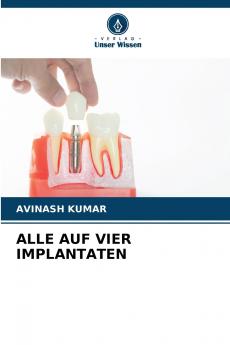 ALLE AUF VIER IMPLANTATEN