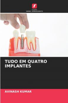 TUDO EM QUATRO IMPLANTES