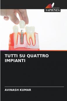 TUTTI SU QUATTRO IMPIANTI