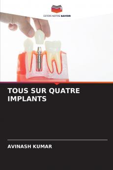 TOUS SUR QUATRE IMPLANTS