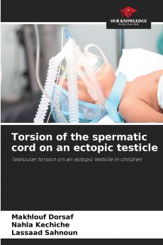 Torsion of the spermatic cord on an ectopic testicle